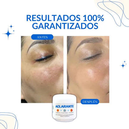 CREMA ACLARANTE NATURAL
